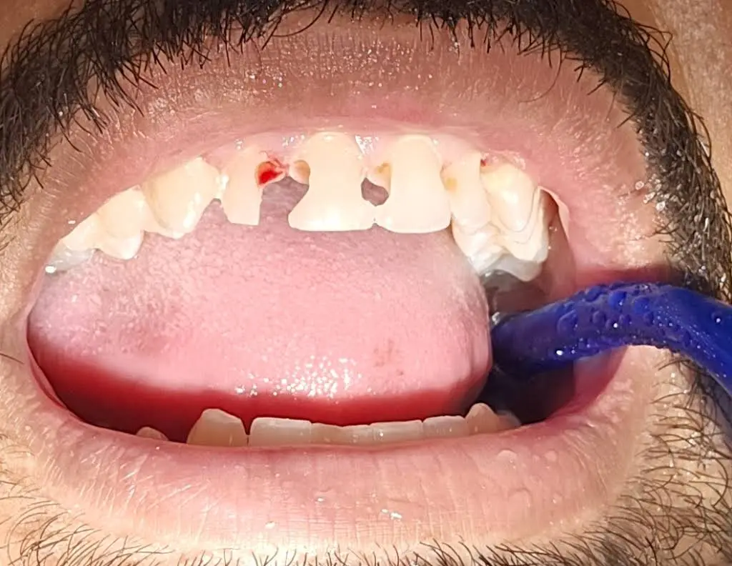 Health Dental of Homestead