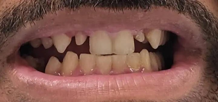Health Dental of Homestead