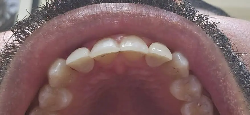 Health Dental of Homestead