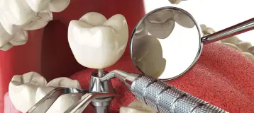 South Dade Dental Specialties Group Homestead