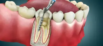 Lynn Haven Dental Specialists
